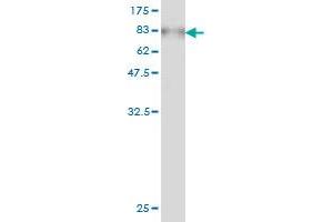 Western Blot detection against Immunogen (78. (AKT1 anticorps  (AA 1-480))