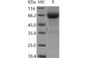 Western Blotting (WB) image for Lymphotoxin beta Receptor (TNFR Superfamily, Member 3) (LTBR) protein (Fc Tag) (ABIN7321203) (LTBR Protein (Fc Tag))