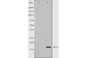 Western blot analysis of skin tissue  lysate using RNASE12antibody. (RNASE12 anticorps  (Internal Region))