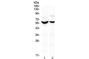 Western blot testing of human 1) HeLa and 2) HepG2 cell lysate with KPNA2 antibody at 0.