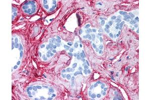 Anti-Collagen VI antibody IHC of human breast. (COL6 anticorps)