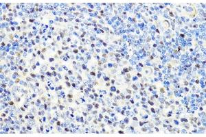 Immunohistochemistry of paraffin-embedded Rat spleen using CTCF Polyclonal Antibody at dilution of 1:100 (40x lens). (CTCF anticorps)