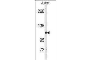 Western blot analysis of anti-anti-DGK delta Pab in Jurkat cell line lysates (35ug/lane)