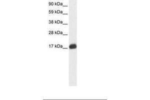 Image no. 2 for anti-E2F Transcription Factor 6 (E2F6) (AA 43-92) antibody (ABIN6735865) (E2F6 anticorps  (AA 43-92))