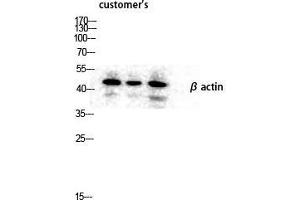 Western Blot (WB) analysis of lysis using Actin beta antibody. (beta Actin anticorps  (N-Term))