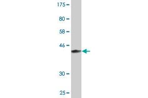 Western Blot detection against Immunogen (37.