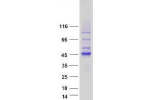 Validation with Western Blot