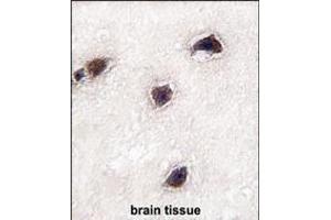 Formalin-fixed and paraffin-embedded human brain tissue reacted with CABP1 antibody (C-term) (ABIN391850 and ABIN2841684) , which was peroxidase-conjugated to the secondary antibody, followed by DAB staining.