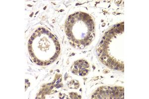 Immunohistochemistry of paraffin-embedded human mammary gland using HDAC5 antibody. (HDAC5 anticorps)