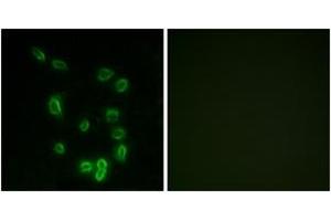 Immunofluorescence analysis of HepG2 cells, using DARPP-32 (Phospho-Thr34) Antibody. (DARPP32 anticorps  (pThr34))