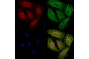 ABIN6257331 and ABIN6275242 staining  cells by IF/ICC. (MRPL3 anticorps  (N-Term))