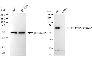 Western blotting analysis using lysyl-tRNA synthetase 1 antibody (ABIN7800951). (Recombinant Lysyl-tRNA Synthetase 1 anticorps)