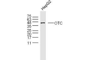 Human HepG2 cells probed with OTC Polyclonal Antibody, unconjugated  at 1:300 overnight at 4°C followed by a conjugated secondary antibody at 1:10000 for 90 minutes at 37°C. (OTC anticorps  (AA 51-150))
