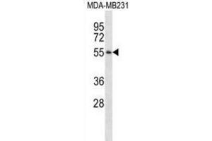 Western Blotting (WB) image for anti-Pepsinogen 3, Group I (Pepsinogen A) (PGA3) antibody (ABIN2995164) (PGA3 anticorps)