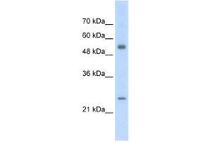 WB Suggested Anti-AK3L1 Antibody Titration:  2. (AK4 anticorps  (Middle Region))