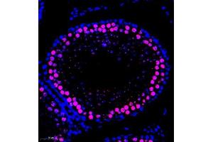 Immunofluorescence of paraffin embedded rat testis using SCP1 (ABIN7075786) at dilution of 1:500 (300x lens)