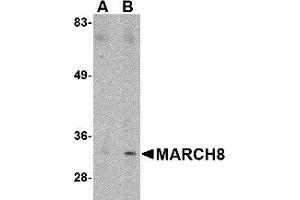 Western Blotting (WB) image for anti-Membrane-Associated Ring Finger (C3HC4) 8, E3 Ubiquitin Protein Ligase (MARCH8) (C-Term) antibody (ABIN1030506) (MARCH8 anticorps  (C-Term))