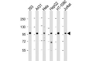 Western Blot at 1:2000 dilution Lane 1: 293 whole cell lysate Lane 2: A431 whole cell lysate Lane 3: Hela whole cell lysate Lane 4: HepG2 whole cell lysate Lane 5: HT-1080 whole cell lysate Lane 6: Jurkat whole cell lysate Lysates/proteins at 20 ug per lane. (DDX21 anticorps  (N-Term))