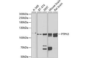 Western blot analysis of extracts of various cell lines, using PTPN3 antibody (ABIN6132535, ABIN6146448, ABIN6146449 and ABIN6222030) at 1:1000 dilution. (PTPN3 anticorps  (AA 1-300))