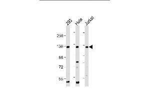 All lanes : Anti-INTS3 Antibody (C-Term) at 1:2000 dilution Lane 1: 293 whole cell lysate Lane 2: Hela whole cell lysate Lane 3: Jurkat whole cell lysate Lysates/proteins at 20 μg per lane. (INTS3 anticorps  (AA 1000-1034))