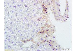Formalin-fixed and paraffin-embedded mouse liver tissue labeled with Rabbit Anti-TNFSF14 Polyclonal Antibody, Unconjugated  1:200 followed by conjugation to the secondary antibody and DAB staining