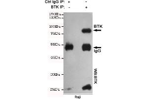 Immunoprecipitation analysis of Raji cell lysates using BTK mouse mAb. (BTK anticorps)