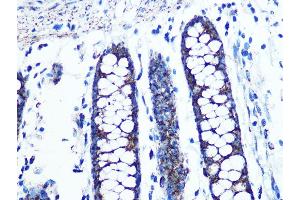 Immunohistochemistry of paraffin-embedded human colon using UQCRC2 Rabbit mAb (ABIN1679334, ABIN3018863, ABIN3018864 and ABIN7101676) at dilution of 1:100 (40x lens).