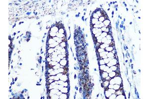 Immunohistochemistry of paraffin-embedded human colon using UQCRC2 Rabbit mAb (ABIN1679334, ABIN3018863, ABIN3018864 and ABIN7101676) at dilution of 1:100 (40x lens). (UQCRC2 anticorps)
