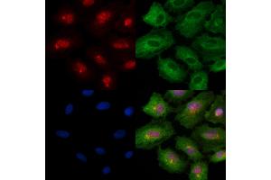 Phospho-Rab8 (Thr72) Antibody staining A549 cells(4h of LPS treatment) by IF/ICC. (RAB8A anticorps  (pThr72))
