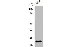 Western Blot analysis of Jurkat cells using D54 Polyclonal Antibody (TPD52L2 anticorps  (C-Term))