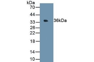 Detection of Recombinant MT1E, Human using Monoclonal Antibody to Metallothionein 1E (MT1E) (MT1E anticorps  (AA 1-61))