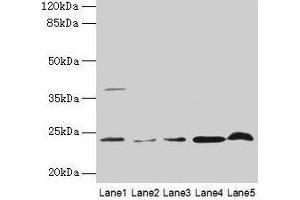 Western blot All lanes: CRYBA1 antibody at 6 μg/mL Lane 1: Human placenta tissue Lane 2: U251 whole cell lysate Lane 3: U937 whole cell lysate Lane 4: Mouse stomach tissue Lane 5: Mouse liver tissue Secondary Goat polyclonal to rabbit IgG at 1/10000 dilution Predicted band size: 26, 24 kDa Observed band size: 24 kDa (CRYBA1 anticorps  (AA 1-215))