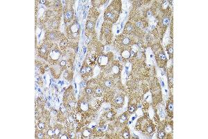 Immunohistochemistry of paraffin-embedded human liver using TST Rabbit pAb  at dilution of 1:200 (40x lens).