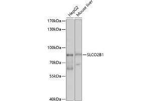 Western blot analysis of extracts of various cell lines, using SLCO2B1 antibody (ABIN6130909, ABIN6148066, ABIN6148067 and ABIN6214197) at 1:1000 dilution. (SLCO2B1 anticorps  (AA 130-210))