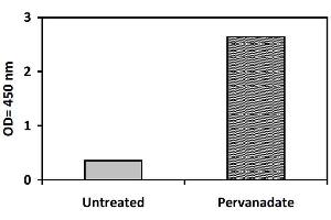 Image no. 3 for EPH Receptor B2 (EPHB2) ELISA Kit (ABIN1981718) (EPH Receptor B2 Kit ELISA)