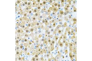 Immunohistochemistry of paraffin-embedded rat liver using PIBF1 Antibody. (PIBF1 anticorps)