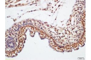 Formalin-fixed and paraffin embedded mouse embryo labeled with Rabbit Anti-KLHL7 Polyclonal Antibody, Unconjugated (ABIN760046) at 1:200 followed by conjugation to the secondary antibody and DAB staining
