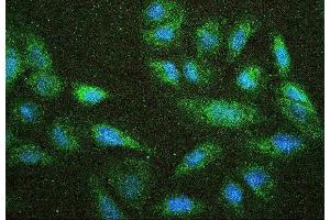 IF analysis of NF2 using anti-NF2 antibody (ABIN7600115) NF2 was detected in immunocytochemical section of U20S cell.