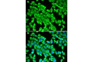 Immunofluorescence analysis of HeLa cells using STIP1 antibody (ABIN5970561). (STIP1 anticorps)