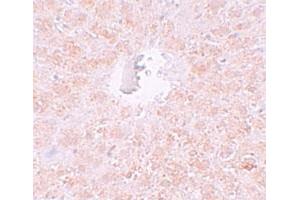 Immunohistochemical staining of rat liver cells with PIWIL1 polyclonal antibody  at 10 ug/mL. (PIWIL1 anticorps  (N-Term))