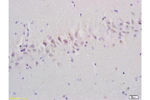 Formalin-fixed and paraffin embedded rat brain tissue labeled with Anti-Emp1/MUC1 Polyclonal Antibody, Unconjugated at 1:200, followed by conjugation to the secondary antibody and DAB staining (EMP1 anticorps  (AA 101-160))