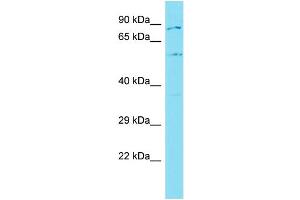 Host: Rabbit Target Name: GLT25D2 Sample Type: MCF7 Whole Cell lysates Antibody Dilution: 1. (GLT25D2 anticorps  (C-Term))