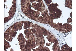 Immunohistochemical staining of paraffin-embedded Human breast tissue using anti-DSTN mouse monoclonal antibody. (Destrin anticorps)