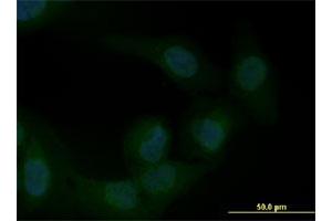 Immunofluorescence of monoclonal antibody to ZEB1 on U-2 OS cell. (ZEB1 anticorps  (AA 801-900))