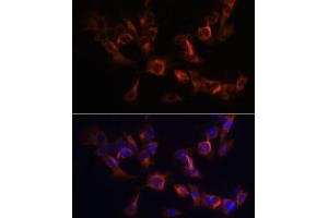 Immunofluorescence analysis of C6 cells using B antibody (ABIN6130859, ABIN6137109, ABIN6137110 and ABIN6220869) at dilution of 1:100.