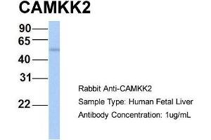 Host: Rabbit  Target Name: CAMKK2  Sample Tissue: Human Fetal Liver  Antibody Dilution: 1. (CAMKK2 anticorps  (N-Term))