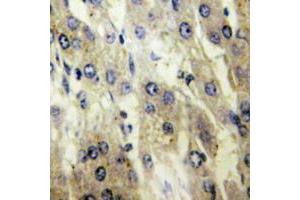 Immunohistochemical analysis of FATP5 staining in human liver formalin fixed paraffin embedded tissue section. (SLC27A5 anticorps  (Center))