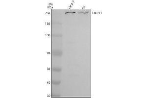Western blot analysis of TRIP11 using anti-TRIP11 antibody (ABIN7825938).