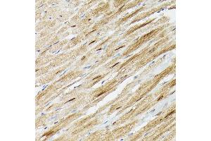 Immunohistochemistry of paraffin-embedded mouse heart using PSM Rabbit pAb (ABIN3021834, ABIN3021835, ABIN3021836 and ABIN6216081) at dilution of 1:100 (40x lens).