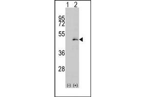 Image no. 1 for anti-Mitogen-Activated Protein Kinase Kinase 1 (MAP2K1) (Ser216) antibody (ABIN360367) (MEK1 anticorps  (Ser216))